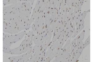 ABIN6273462 at 1/100 staining Mouse heart tissue by IHC-P. (CENPN anticorps  (C-Term))
