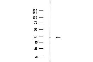 anti-DNA Meiotic Recombinase 1 (DMC1) (Internal Region) antibody