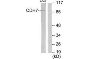 Western blot analysis of extracts from A549 cells, using CDH7 Antibody. (Cadherin 7 anticorps  (AA 651-700))