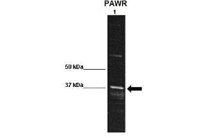 WB Suggested Anti-PAWR Antibody    Positive Control:  Lane 1: 30ug rat striatum homogenate  Primary Antibody Dilution :   1:1000  Secondary Antibody :  Anti rabbit-HRP   Secondry Antibody Dilution :   1:10,000  Submitted by:  Kristy Shimp, University of Florida (PAWR anticorps  (Middle Region))