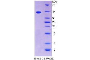 SDS-PAGE (SDS) image for Tropomyosin-2 (TPM2) (AA 1-284) protein (His tag) (ABIN6238635) (TPM2 Protein (AA 1-284) (His tag))