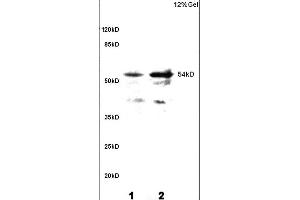 L1 and L2 rat brain lysates probed with Anti Phospho-CaMKII (Thr286) Polyclonal Antibody, Unconjugated (ABIN732473) at 1:200 overnight at 4 °C.
