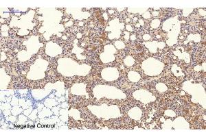 Immunohistochemistry (IHC) image for anti-Neighbor of BRCA1 Gene 1 (NBR1) antibody (ABIN5957970) (NBR1 anticorps)