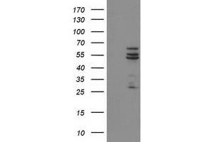 Western Blotting (WB) image for anti-Cytochrome P450, Family 2, Subfamily C, Polypeptide 9 (CYP2C9) antibody (ABIN1497725) (CYP2C9 anticorps)