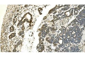 IHC analysis of Carbonic Anhydrase 13/CA13 using anti-Carbonic Anhydrase 13/CA13 antibody (ABIN7603164). (CA13 anticorps  (N-Term))