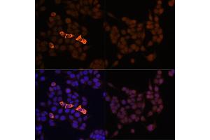 Immunofluorescence analysis of HeLa-Myc-CandHeLa cells using Rabbit anti Myc-Tag pAb-C-terminal (ABIN3020568 and ABIN3020569) at dilution of 1:100 (40x lens). (Myc Tag anticorps)