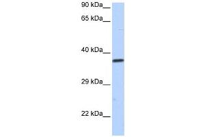 Western Blotting (WB) image for anti-Sex Comb On Midleg-Like 1 (SCML1) antibody (ABIN2458174) (SCML1 anticorps)