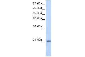 WB Suggested Anti-MIF4GD Antibody Titration:  1. (MIF4GD anticorps  (C-Term))