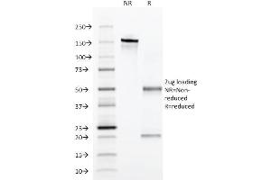SDS-PAGE Analysis Purified Alpha-1-Antitrypsin Mouse Monoclonal Antibody (AAT/1379). (SERPINA1 anticorps)