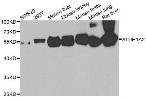 Western blot analysis of extracts of various cell lines, using ALDH1A2 antibody. (ALDH1A2 anticorps  (AA 1-180))
