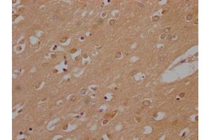 IHC image of ABIN7140049 diluted at 1:200 and staining in paraffin-embedded human brain tissue performed on a Leica BondTM system. (LPPR1 anticorps  (AA 51-66))