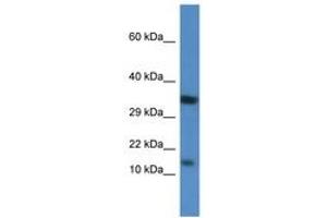 Image no. 1 for anti-Protein Kinase (CAMP-Dependent, Catalytic) Inhibitor beta (PKIB) (AA 40-89) antibody (ABIN6746525) (PKIB anticorps  (AA 40-89))