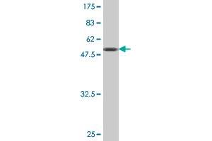 Western Blot detection against Immunogen (51. (TK1 anticorps  (AA 1-234))