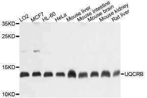 Western blot analysis of extracts of various cell lines, using UQCRB antibody. (UQCRB anticorps  (AA 1-111))