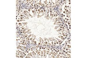 Immunohistochemistry of paraffin embedded rat testis using CDY1 (ABIN7073493) at dilution of 1:400 (300x lens)