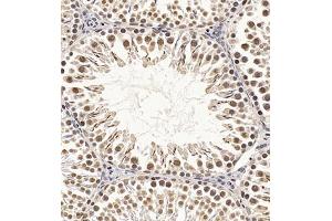 Immunohistochemistry of paraffin embedded rat testis using CDY1 (ABIN7073493) at dilution of 1:400 (300x lens) (CDY1 anticorps)