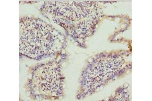 Immunohistochemistry of paraffin-embedded human small intestine tissue using ABIN7171763 at dilution of 1:100 (TNS3 anticorps  (AA 1-240))
