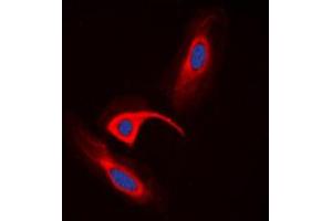 Immunofluorescent analysis of CBR1 staining in HeLa cells. (CBR1 anticorps  (Center))