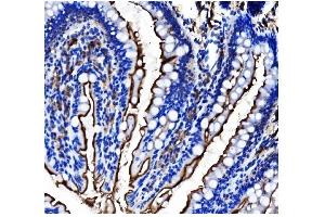 IHC analysis of CD13/ANPEP using anti-CD13/ANPEP antibody (ABIN7600088). (CD13 anticorps  (AA 148-966))