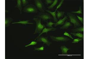 Immunofluorescence of purified MaxPab antibody to CTDSP2 on HeLa cell. (CTDSP2 anticorps  (AA 1-271))