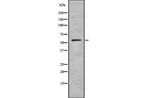 Western blot analysis of RIOK3 using K562 whole cell lysates (RIOK3 anticorps  (Internal Region))
