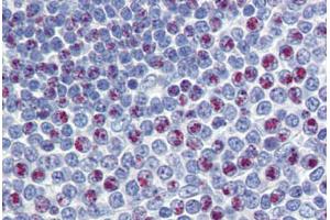 Spleen, Human: Formalin-Fixed, Paraffin-Embedded (FFPE) (FOXM1 anticorps  (C-Term))