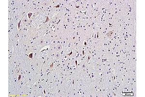 Formalin-fixed and paraffin embedded rat brain labeled with Anti-GRM5/mGluR5 Polyclonal Antibody, Unconjugated (ABIN673914) followed by conjugation to the secondary antibody and DAB staining (Metabotropic Glutamate Receptor 5 anticorps  (AA 201-300))