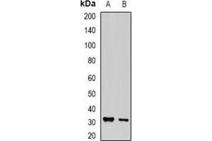 Western blot analysis of PA28 gamma expression in MCF7 (A), PC12 (B) whole cell lysates.