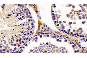 Detection of HMGCS2 in Mouse Testis Tissue using Polyclonal Antibody to Hydroxymethylglutaryl Coenzyme A Synthase 2, Mitochondrial (HMGCS2) (Hydroxymethylglutaryl Coenzyme A Synthase 2, Mitochondrial (AA 1-167) anticorps)
