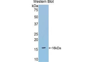 Western blot analysis of the recombinant protein. (DBR1 anticorps  (AA 133-241))