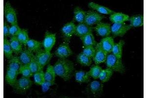 anti-WW Domain Containing Oxidoreductase (WWOX) (AA 1-245) antibody
