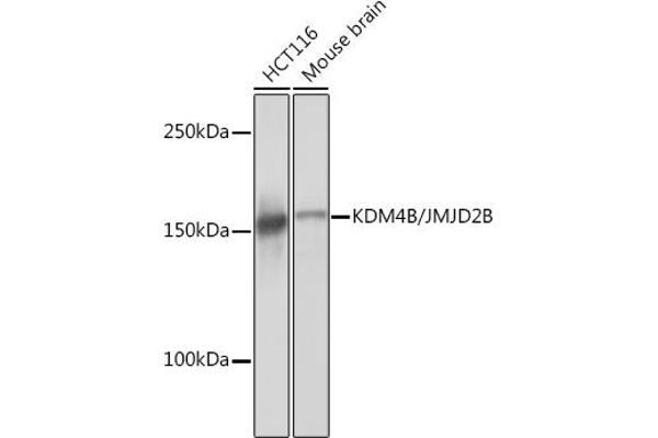 KDM4B anticorps