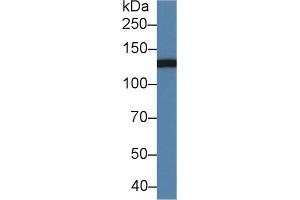 Detection of CD11b in Mouse Serum using Polyclonal Antibody to Integrin Alpha M (CD11b) (CD11b anticorps  (AA 808-931))