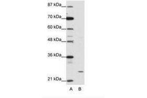 Image no. 1 for anti-Zinc Finger Protein 253 (ZNF253) (C-Term) antibody (ABIN202147) (ZNF253 anticorps  (C-Term))
