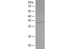 Western Blotting (WB) image for Microtubule-Associated Protein, RP/EB Family, Member 2 (MAPRE2) (AA 1-327) protein (His-IF2DI Tag) (ABIN7123965)