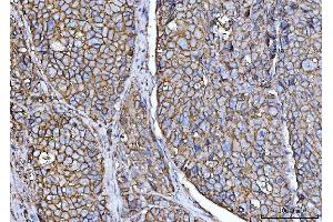 IHC analysis of CD147/Emmprin using anti-CD147/Emmprin antibody (ABIN7599997).