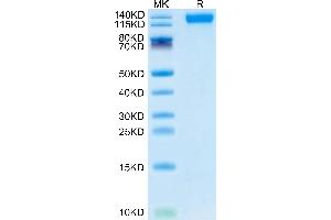 SARS-COV-2 Spike S1(B.