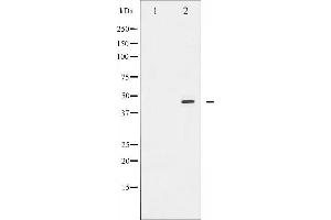 Western blot analysis of E2F1 expression in Etoposide treated HeLa whole cell lysates,The lane on the left is treated with the antigen-specific peptide. (E2F1 anticorps  (C-Term))