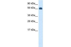 Human Lung; WB Suggested Anti-ZNF499 Antibody Titration: 0. (ZBTB45 anticorps  (Middle Region))