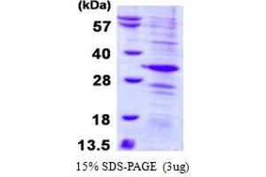 Image no. 1 for Adenosylmethionine Decarboxylase 1 (AMD1) protein (His tag) (ABIN7279870)