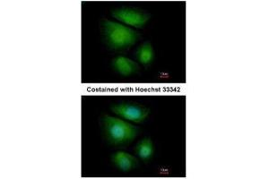 ICC/IF Image Immunofluorescence analysis of paraformaldehyde-fixed MCF-7, using RNF13, antibody at 1:500 dilution.