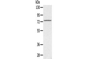 Gel: 6 % SDS-PAGE,Lysate: 40 μg,Primary antibody: ABIN7192448(SLC26A5 Antibody) at dilution 1/200 dilution,Secondary antibody: Goat anti rabbit IgG at 1/8000 dilution,Exposure time: 3 minutes (SLC26A5 anticorps)