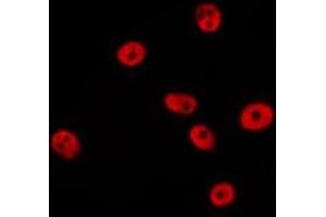 ABIN6277196 staining HepG2 by IF/ICC.