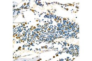 Immunohistochemistry of paraffin embedded mouse bone using CD110 (ABIN7074718) at dilution of 1:1000 (400x lens) (MPL anticorps)