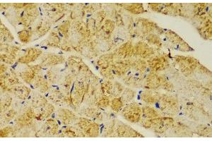 Immunohistochemistry of paraffin-embedded Mouse heart using ACTN1 Polyclonal Antibody at dilution of 1:100 (40x lens). (ACTN1 anticorps)
