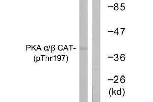 Western blot analysis of extracts from mouse brain cells using PKA α/β CAT (Phospho-Thr197) Antibody. (PRKACA anticorps  (pThr197))