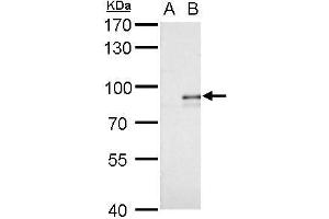 WB Image Alkyl-DHAP synthase antibody detects Alkyl-DHAP synthase protein by western blot analysis. (AGPS anticorps)