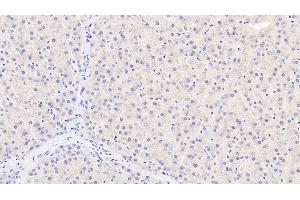 Detection of TDO in Human Liver Tissue using Monoclonal Antibody to Tryptophan-2,3-dioxygenase (TDO) (TDO2 anticorps  (AA 1-406))