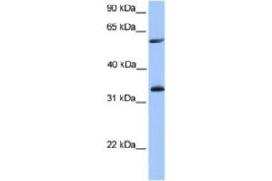Western Blotting (WB) image for anti-Testis-Specific serine Kinase Substrate (TSKS) antibody (ABIN2463605) (TSKS anticorps)