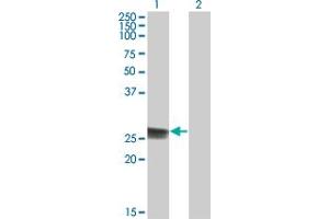 Western Blot analysis of TK1 expression in transfected 293T cell line by TK1 monoclonal antibody (M05), clone 3F9. (TK1 anticorps  (AA 1-234))